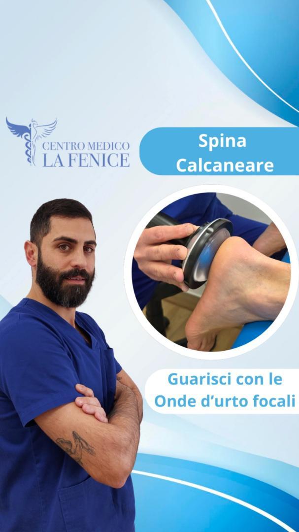 Trattamento della spina calcaneare con onde d'urto presso il Centro Medico La Fenice di Bracciano.